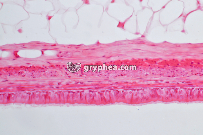 Trachée x100 - gryphea.com